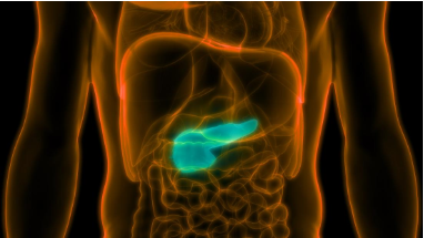 Cancer of the pancreas — shown here — may soon be easier to treat due to recent findings.